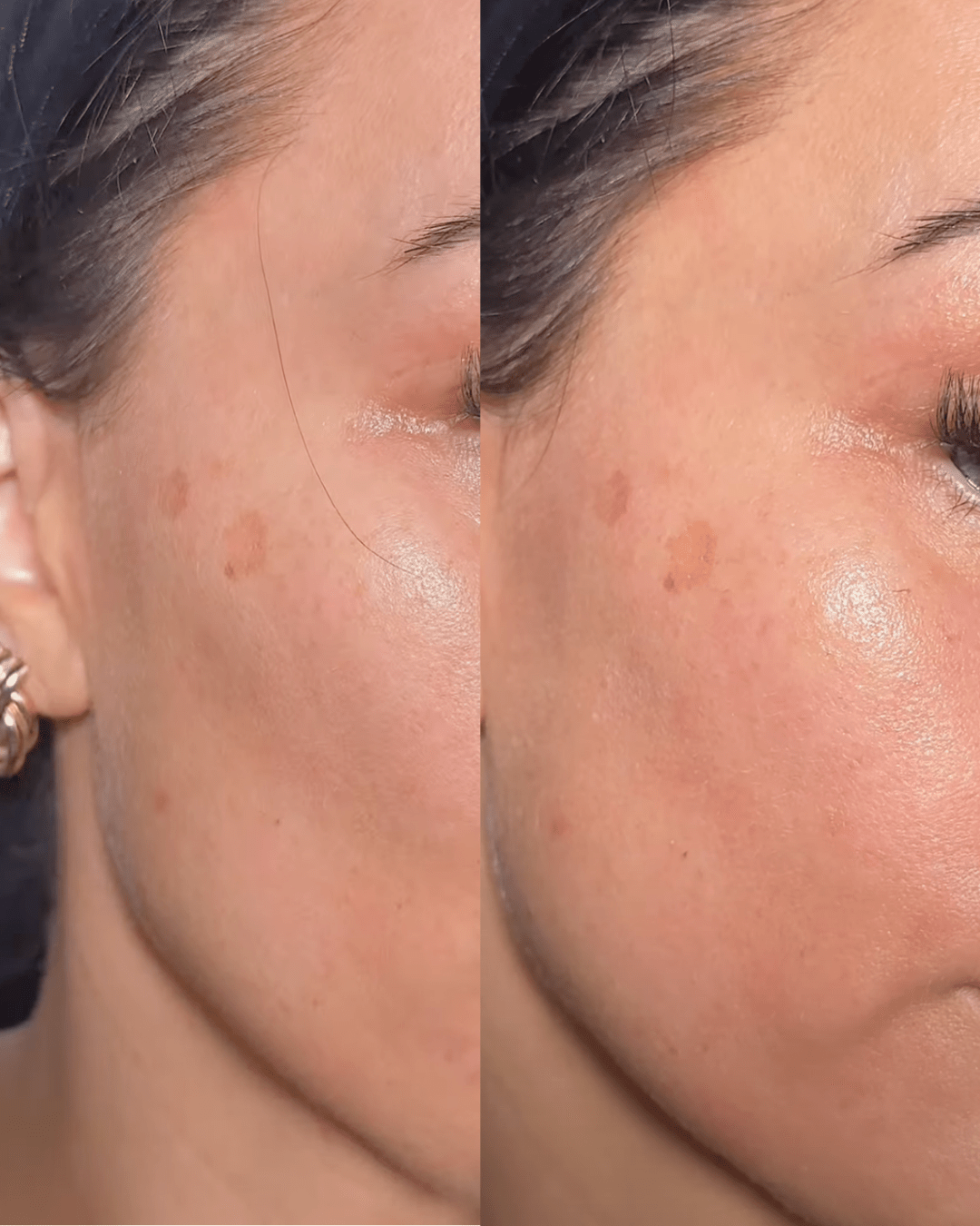 SPF 50 Face Cream (UVA & UVB) - Opretty