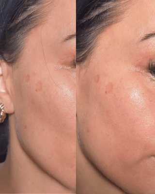 SPF 50 Face Cream (UVA & UVB) - Opretty