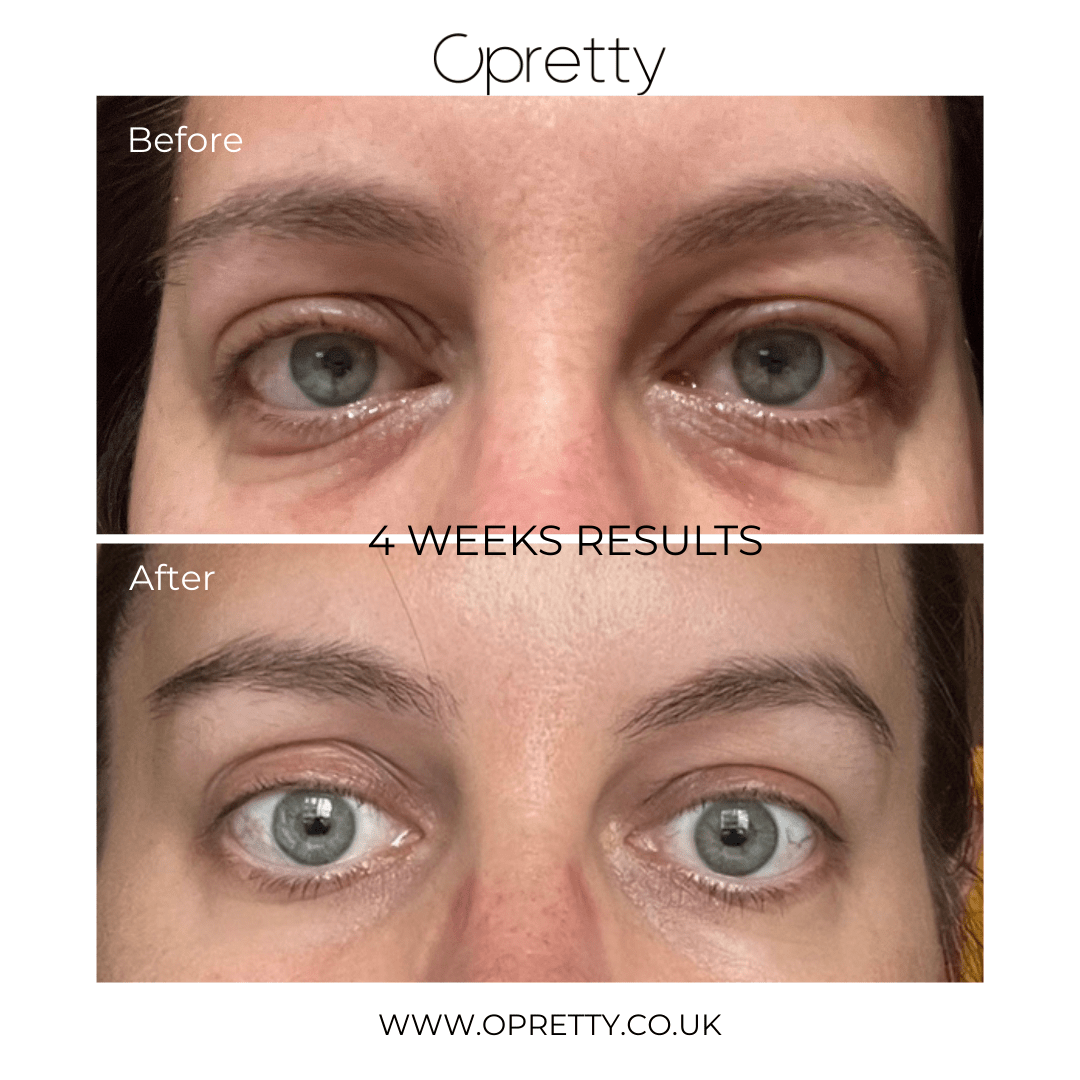 Anti-Ageing Brightening Eye Cream - Opretty