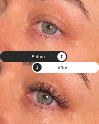 Before and after comparison of a person's eye with skincare product application.